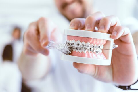 Braces cleaning | © Braces cleaning